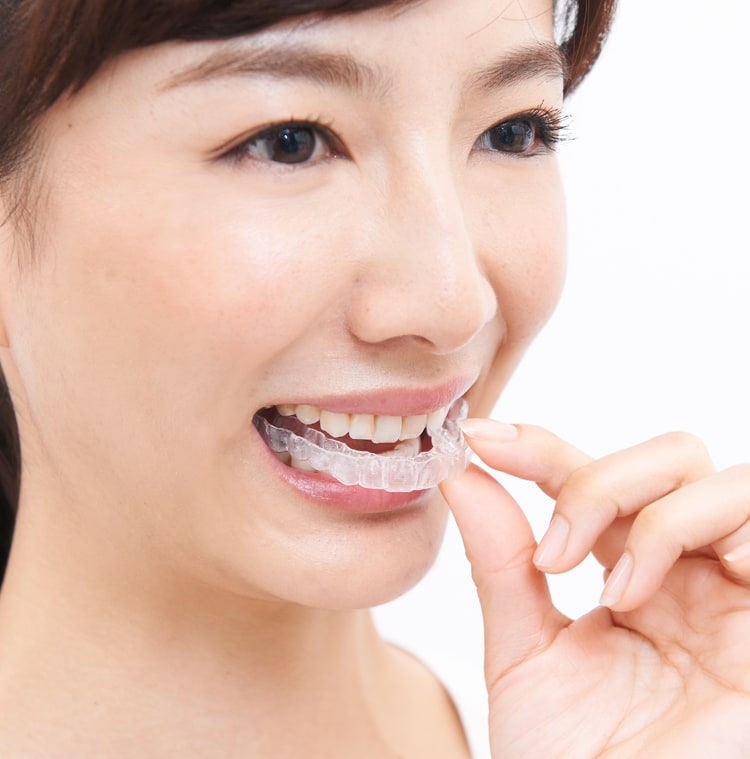 インビザラインメリット