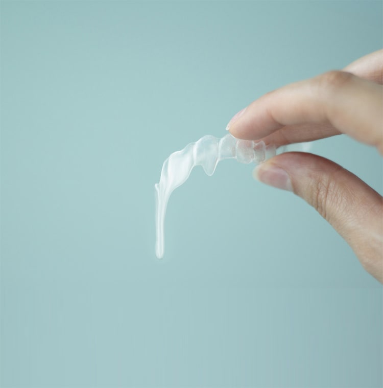 インビザラインデメリット